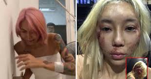 However, leng yein has surprisingly withdrawn her report today and stated that she will not take any legal action towards peter. Malaysian Dj Leng Yein Posts Photos Of Bloodied Self On Fb Accuses Ex Boyfriend Of Abuse Over Past 2 Years Malaysia News Asiaone
