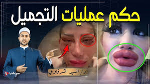 ‫احذرووووا... عمليات التجميل بين الحلال والحرام ومتى تكون ضرورية ويجب فعلها  دون تأخير؟ - YouTube‬‎