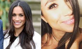 Lots of images may come to mind when you think of plastic surgery. Meghan Markle Effect Sees More Women Requesting Nose Jobs Daily Mail Online