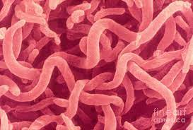 It is a facultative anaerobe, thus capable of using oxygen for aerobic respiration under aerobic conditions, or an alternative terminal electron acceptor for anaerobic respiration under anaerobic conditions. Rhodospirillum Rubrum Sem Photograph By Scimat