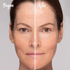 INSTANT EFFECTS Pm Recovery