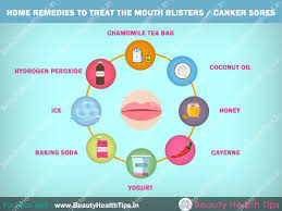 3 home remedies to get rid of mouth ulcers under tongue 1)? Home Remedies To Treat Mouth Blisters Canker Sores Beauty Health Tips