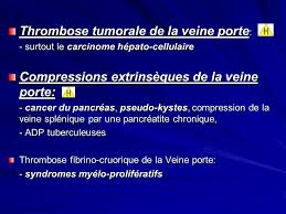 Hypertension Portale Ppt Video Online Telecharger