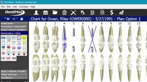 charting in dentimax 18 dentimax dental software tip