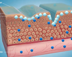 Image of Sodium hyaluronate crosspolymer