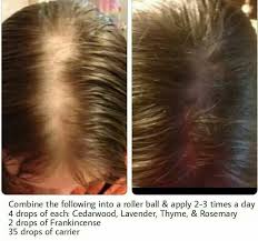 Pin On Hair Scalp Essential Oil