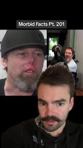 Greg Manteufel After Dog Licks Him