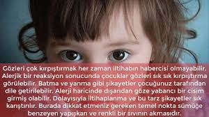 Goz Iltihabi Akarak Belirti Verir Goz Iltihabi Burundan Akan Sumuge Benzer Eger Cocugunuzun Gozunden Boyle Bir Akinti Geliyorsa Mutlak Batman Doktorlar Cocuk