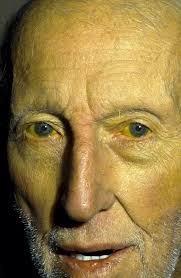 Skin Symptoms and AIHA: What Do They Look Like?