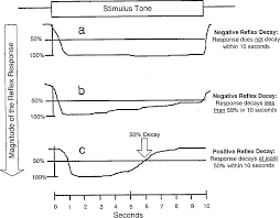 Image result for Reflex Exam