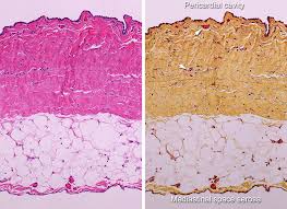 Image result for Pericardium