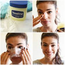 Now readinghow to get rid of whiteheads without destroying your skin, according to a dermatologist. 8 Natural Ways To Get Rid Of Blackheads And Whiteheads Fast