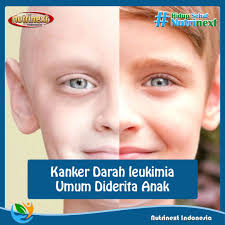 Pin Di Info Sehat