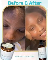 𝚂𝚒𝚖𝚘𝚗𝚎'𝚜 𝚂𝚔𝚒𝚗 𝙲𝚊𝚛𝚎 𝙻𝙻𝙲 👑 (@simonesskincare_) • Instagram  photos and videos