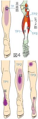 Ulož.to je v čechách a na slovensku jedničkou pro svobodné sdílení souborů. ãƒˆãƒªã‚¬ãƒ¼ãƒã‚¤ãƒ³ãƒˆã«ã‚ˆã‚‹è† ä¸‹è…¿ è¶³ã®ç—›ã¿ ã‚„ã¾ã ã‚«ã‚¤ãƒ­ãƒ—ãƒ©ã‚¯ãƒ†ã‚£ãƒƒã‚¯ é¼ç¸é™¢ãƒ›ãƒ¼ãƒ  ãƒšãƒ¼ã‚¸