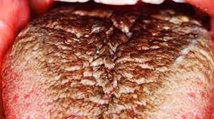 Hair In Your Mouth And Why It S Growing
