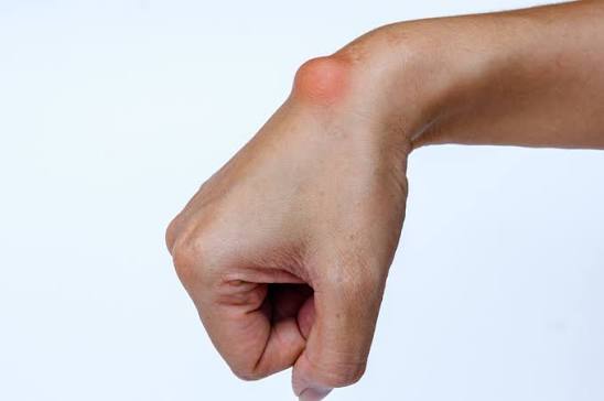 All About Lumps & Bumps &ndash; Uncancer LLC