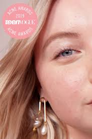 Pimples on the chin are very common and they appear because of hormonal imbalance in the body. How To Pop A Pimple Properly Even Though You Really Shouldn T Teen Vogue