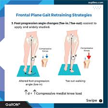 Image result for Foot Progression Angle