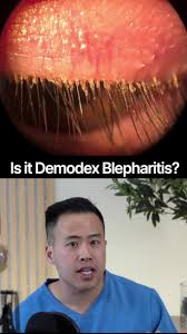 Image result for Blepharis sol