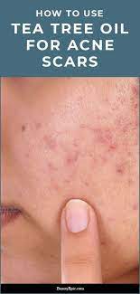 Pin On Tea Tree Oil For Skin