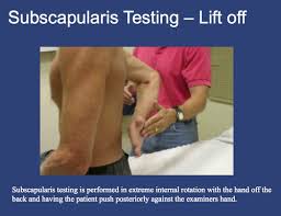 Image result for Lift-Off Subscapularis Test