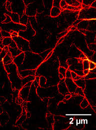 The absence of a confocal (left) and sted (right) imaging of abberior star635p labeled vimentin. Gfp Booster Chromotek