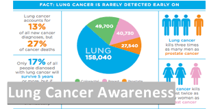 One out of every seven people diagnosed each year have never smoked. Lung Cancer Fact Sheet