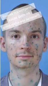 Кэтнэп Фотки