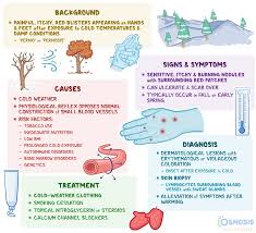 Image result for Chilblains