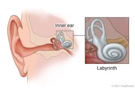 Image result for Bacterial Labyrinthitis