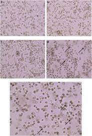 Assuming the date is today and your time zone is mst. Hypericin Photodynamic Therapy Leads To Interleukin 6 Secretion By Hepg2 Cells And Their Apoptosis Via Recruitment Of Bh3 Interacting Domain Death Agonist And Caspases Cell Death Disease