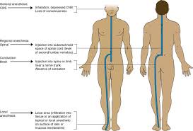 Image result for Local Skin Anesthesia