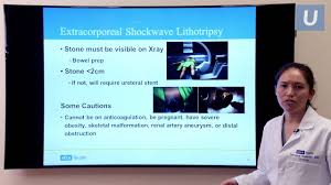 Bowel Preparation For Surgery | Ppt