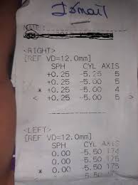 Goz Gorme Derecesine Gore Verilecek Rapor Oranlari Hakkinda Guncel Bilgi 27 Sayfa