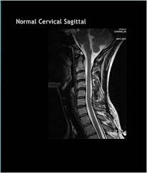 Mri can look at the spine in the neck (cervical), upper back (thoracic), . Suffering From Back Pain And Neck Pain