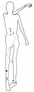 Otzi the iceman mummy was discovered in the italian alps in 1991. Tattoos On The Body Of The Ice Man Otzi After Spindler 1994 Download Scientific Diagram