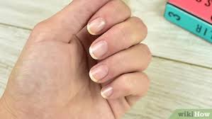 Hey guys heres a basic tutorial on how i nurse my jacked up nails back to health after having acrylic nails for 4+ months :) hope you enjoy and this video. 3 Ways To Help Your Nails Recover After Acrylics Wikihow