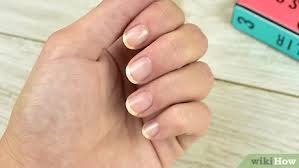 It took long 8 months to get them back into shape! 3 Ways To Help Your Nails Recover After Acrylics Wikihow