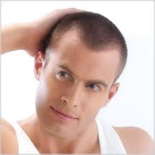 Saclari Dokulen Erkekler Icin Sac Modelleri Sac Modelleri