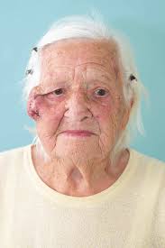 Clinical situation at the initial presentation at the outpatient clinic.