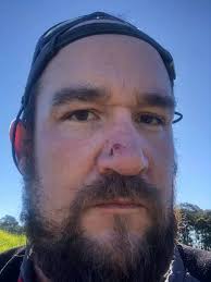 Whattt?? There's blood