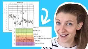 There are three easy ways; How To Read An Audiogram Youtube