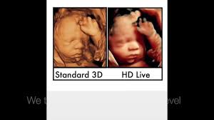 Prc of metro richmond is listed by the virginia department of health as a clinic that provides free ultrasounds. A New Ultrasound Experience Ultrasound Ultrasound Pictures Baby Ultrasound