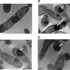 Selain itu, protein whey juga dapat digunakan sebagai. Pdf Green Fluorescent Protein As A Scaffold For High Efficiency Production Of Functional Bacteriotoxic Proteins In Escherichia Coli