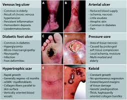 Use sterile saline solution if you have some in your first aid kit. Recent Advances In Inorganic Nanomaterials For Wound Healing Applications Biomaterials Science Rsc Publishing
