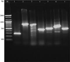 Molecular Determination Of Antimicrobial Resistance In Escherichia Coli Isolated From Raw Meat In Addis Ababa And Bishoftu Ethiopia Springerlink