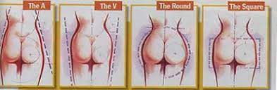 This particular shape is caused by either higher more prominent hip bones (you may even have hip dips), or a distribution of fat in the 'love handle' area. Is There Any Way To Fix A Square Butt Fitness