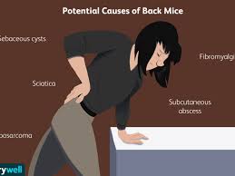 If you are suffering from a stiff, aching hip, there's a chance that you have developed bursitis. Back Mice Symptoms And Diagnosis