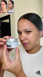 Crema hidratante de baba de caracol #VGO #vgobeauty #paratiiiiiiiiiiii...